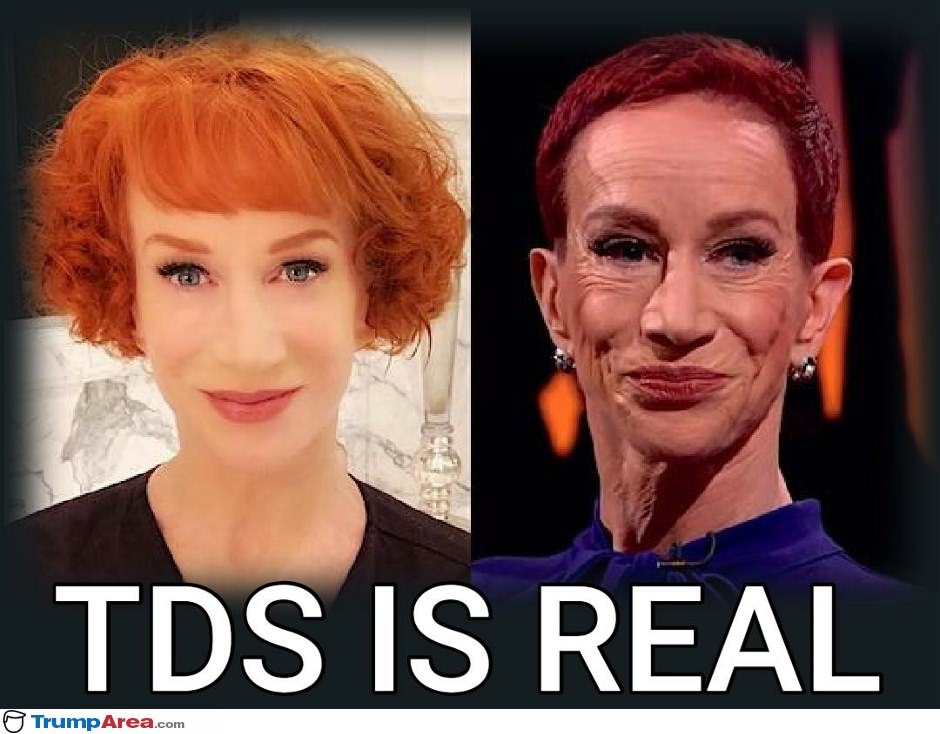 TDS is real