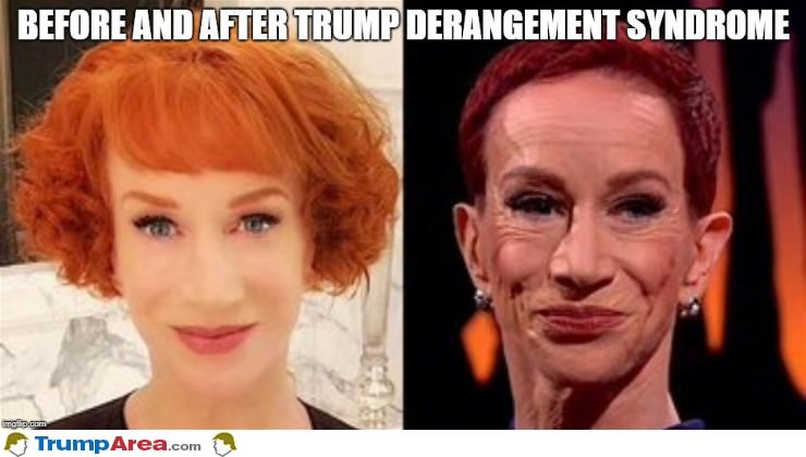 Trump Acceptance Derangement Syndrome